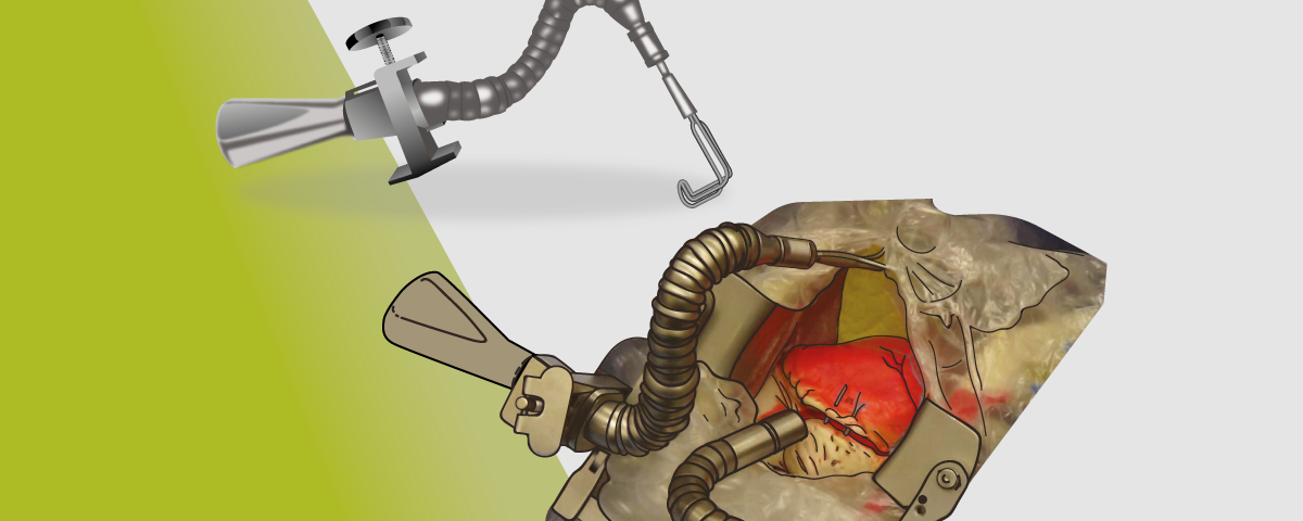 Product Training and Instructions for Use: Universal Stabilizer Arms